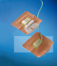 Dispositivo de Fijación con Hidrocoloide para Catéteres Percutáneos - Pequeño