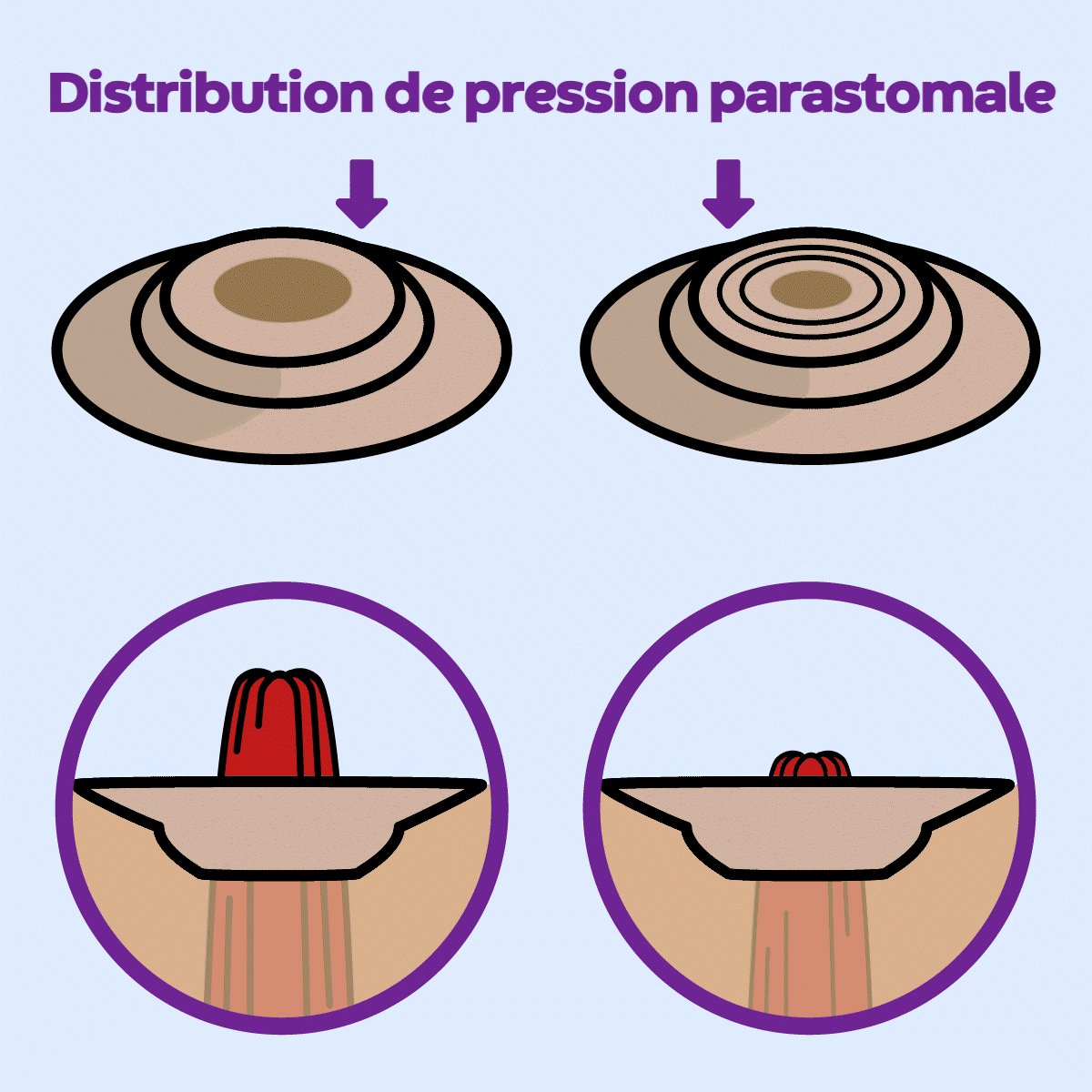Répartition