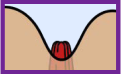 Dobras cutâneas